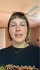 Jessica Rosacea-ltd testimonial video